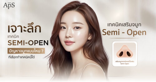 ทำจมูกเทคนิค Semi Open