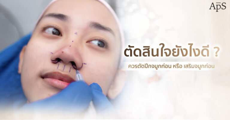 ตัดปีกจมูก