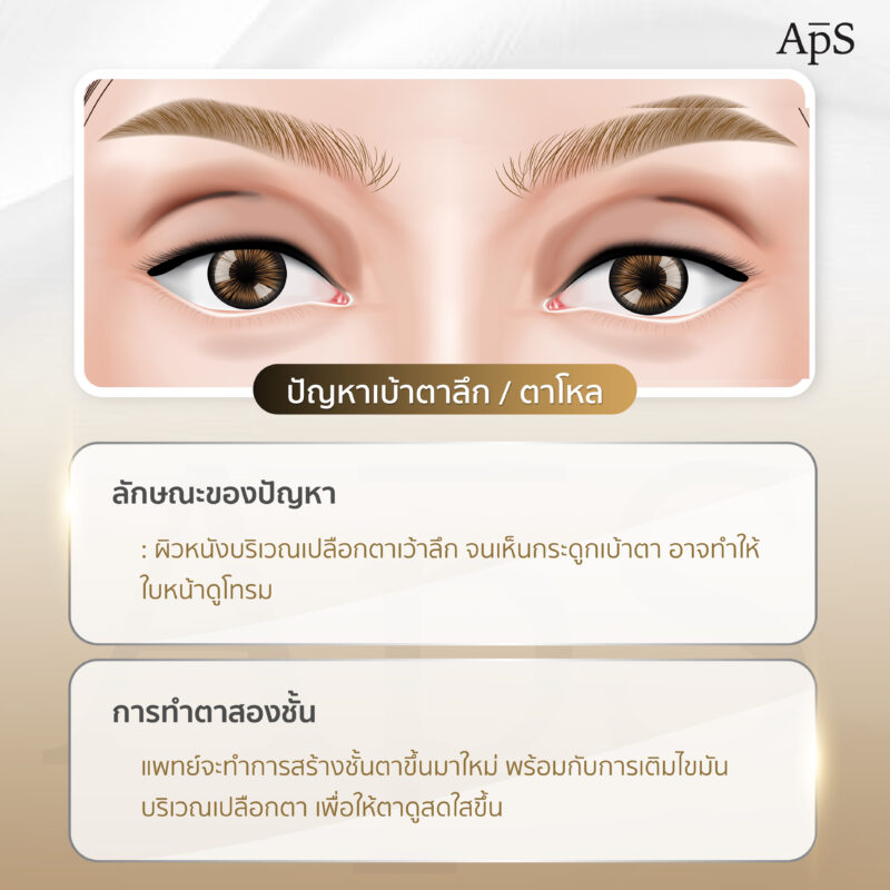ปัญหาเบ้าตาลึก