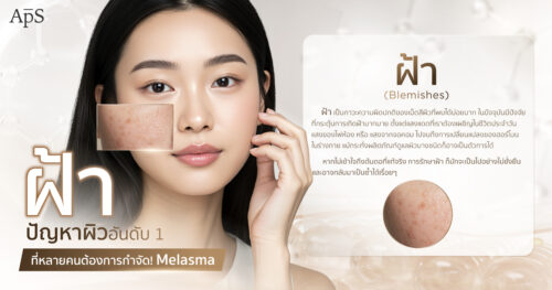 รักษาฝ้า