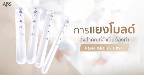 แยงโมลด์