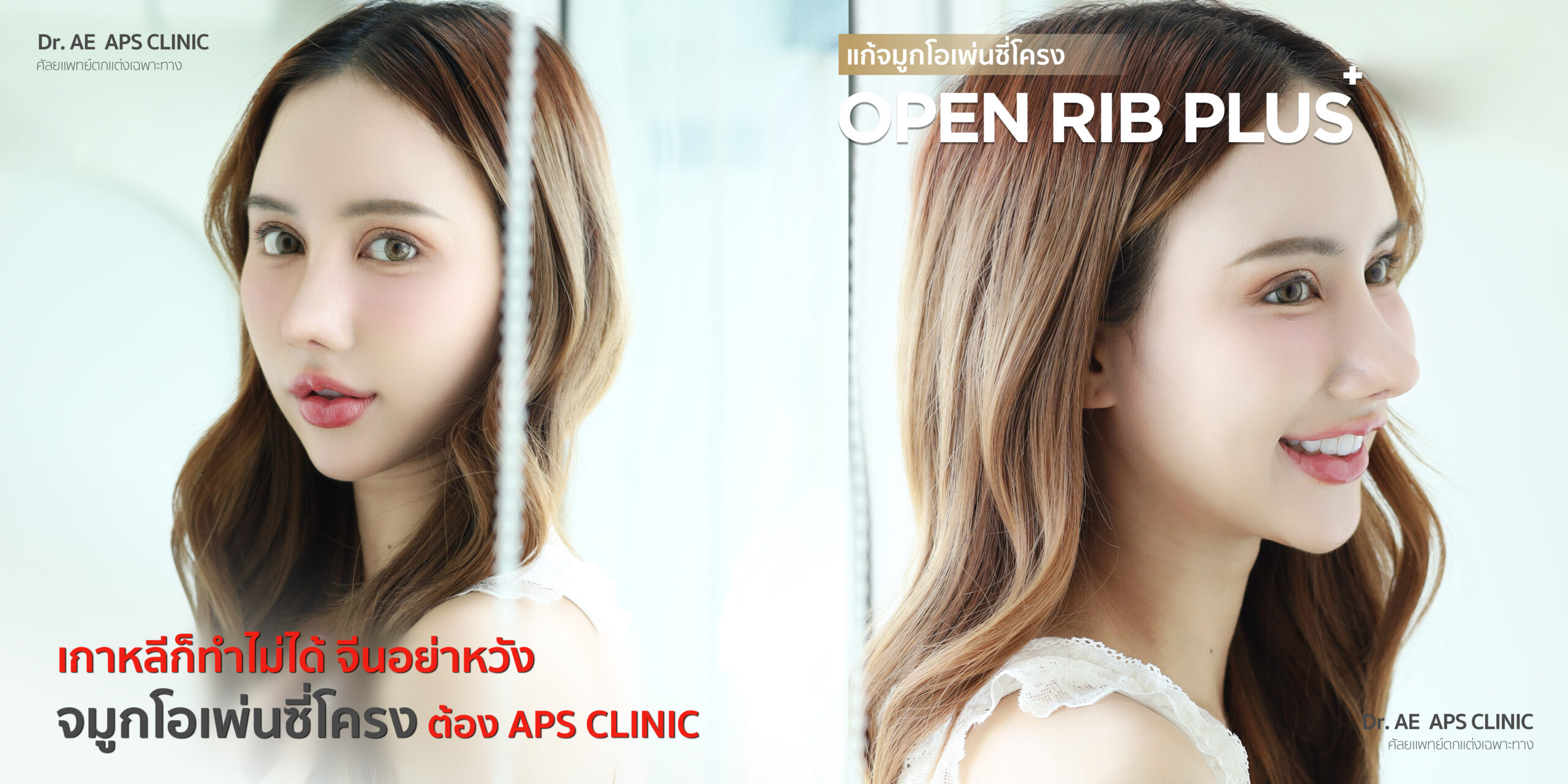 แก้จมูกที่ APS Clinic ถูกใจกว่าทำที่เกาหลี รีวิวคุณกุ๊กไก่ 1 รีวิวคุณกุ๊กไก่