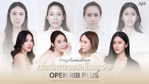 รีวิวเสริมจมูกเทคนิค Open rib plus+