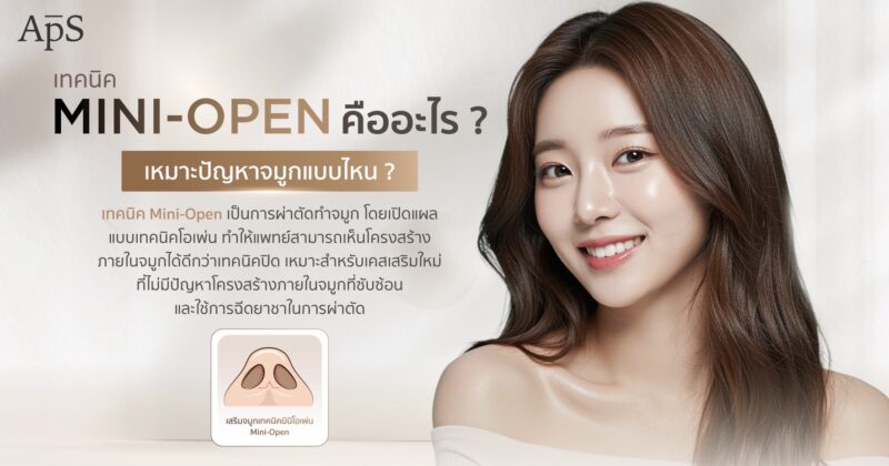 การเตรียมตัวก่อนทำจมูกเทคนิค Mini Open