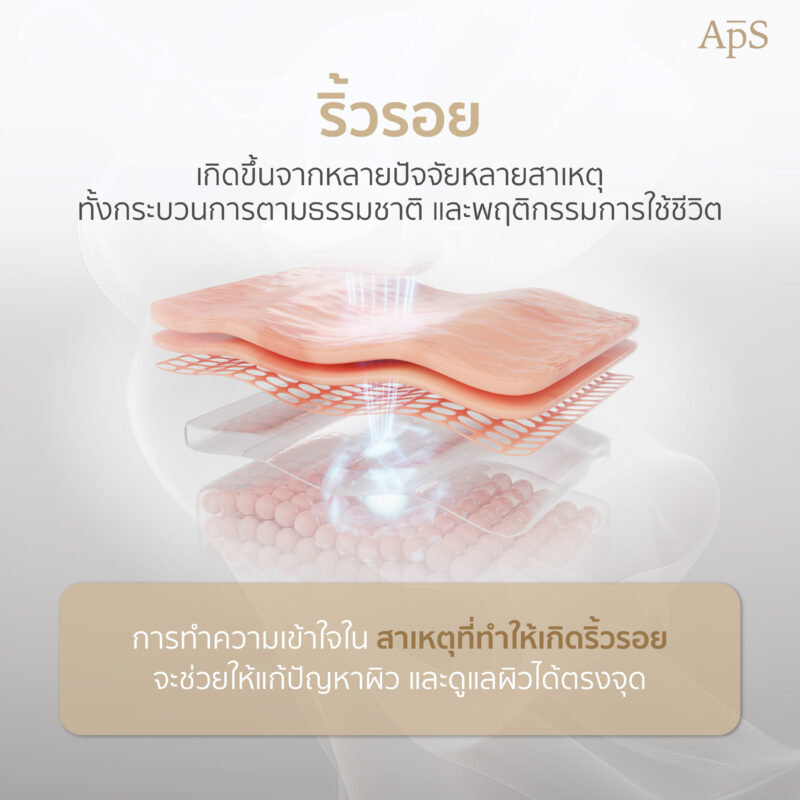 ปัจจัยที่ทำให้เกิดริ้วรอย