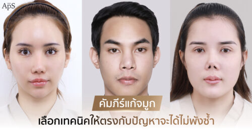 ทำไมต้องแก้จมูก