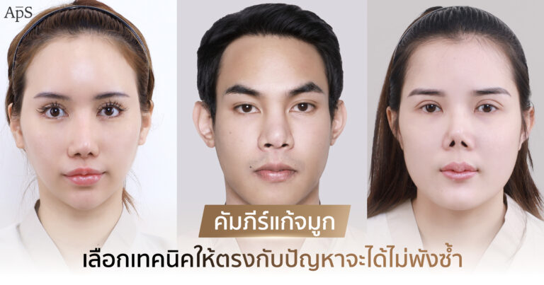 ทำไมต้องแก้จมูก