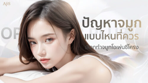 การทำจมูกเทคนิคโอเพ่นซี่โครงเหมาะกับใคร