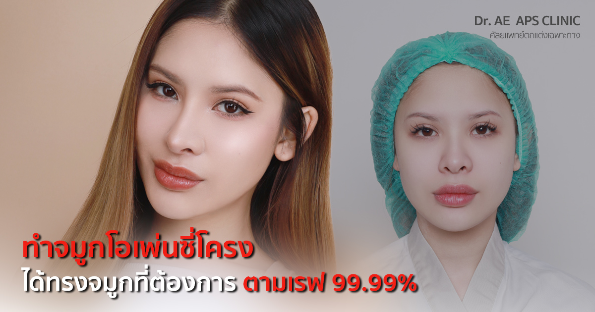 เปลี่ยนทรงจมูกใหม่ให้ดูสวยละมุนขึ้น คุณมิวสิก