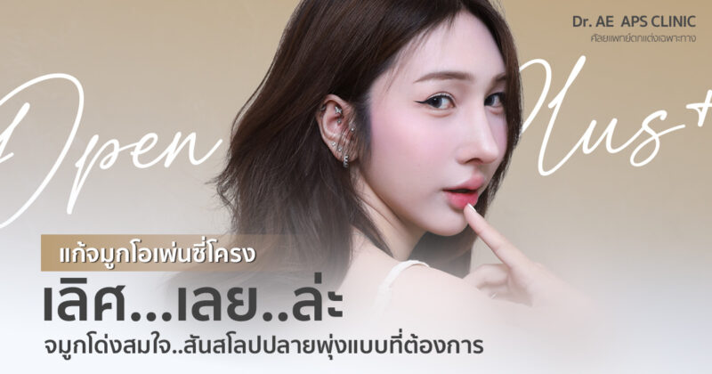รีวิวแก้จมูกครั้งที่ 3 รอบ ก่อนตัดสินใจแก้จมูกโอเพ่นซี่โครง