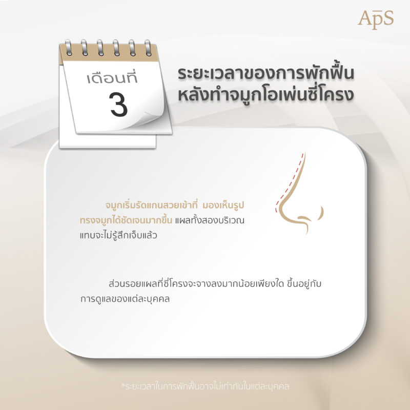 ทำจมูกโอเพ่นซี่โครงพักฟื้นนานไหม? 7 ทำจมูกโอเพ่นซี่โครงพักฟื้น เดือนที่ 3