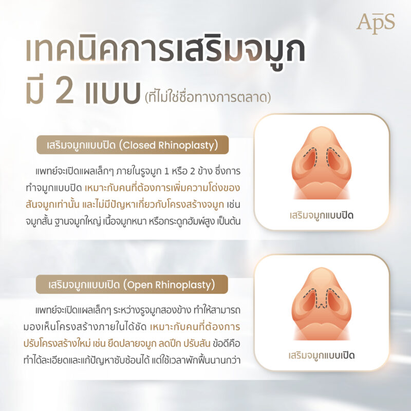 การเสริมจมูก