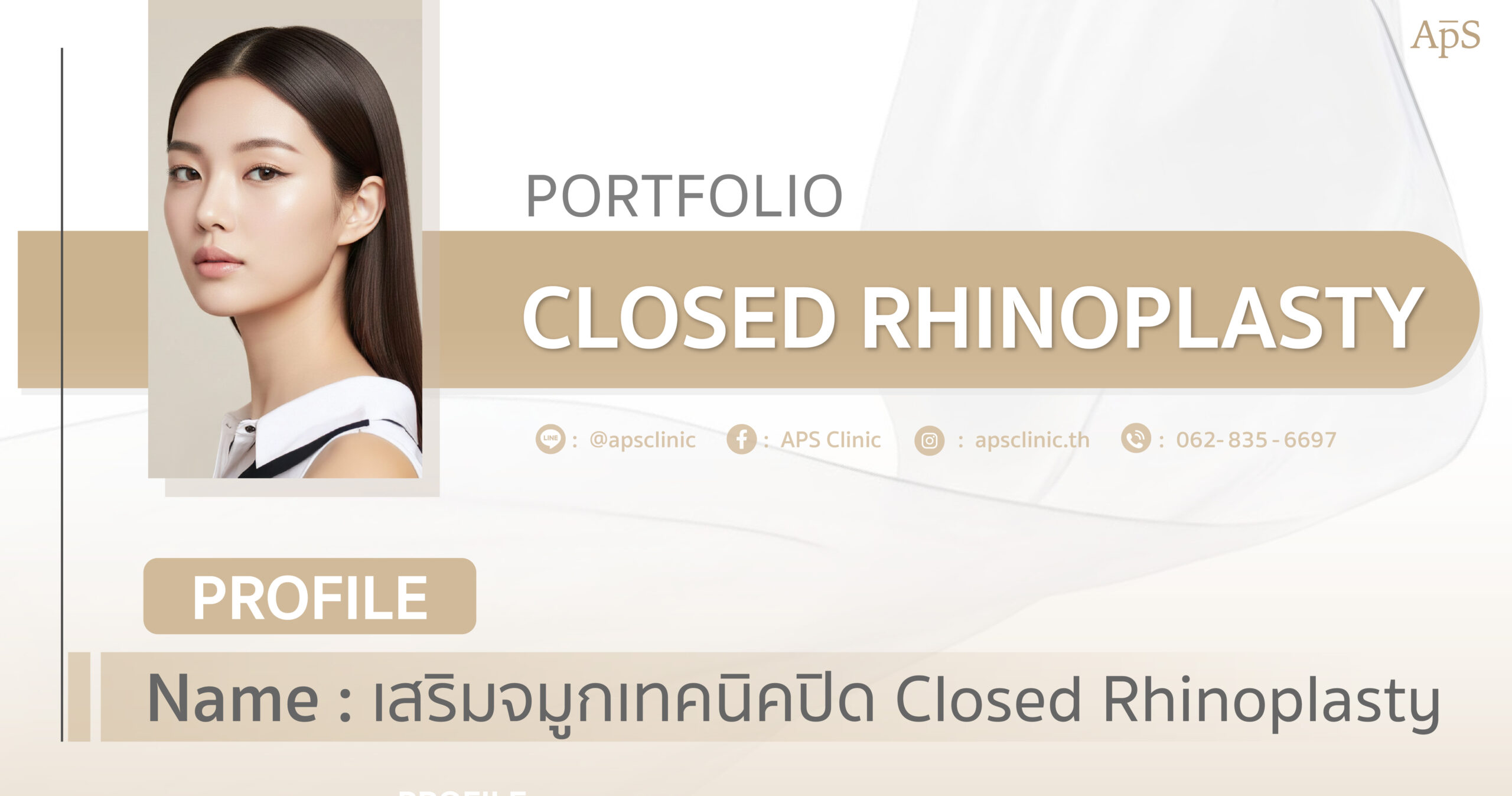 ทำจมูกเทคนิคปิดเหมาะกับใคร