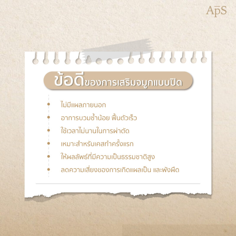 ข้อดีของการทำจมูกเทคนิคปิด