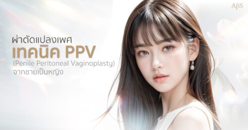 ผ่าตัดแปลงเพศเทคนิค PPV Penile Preserving Vaginoplasty