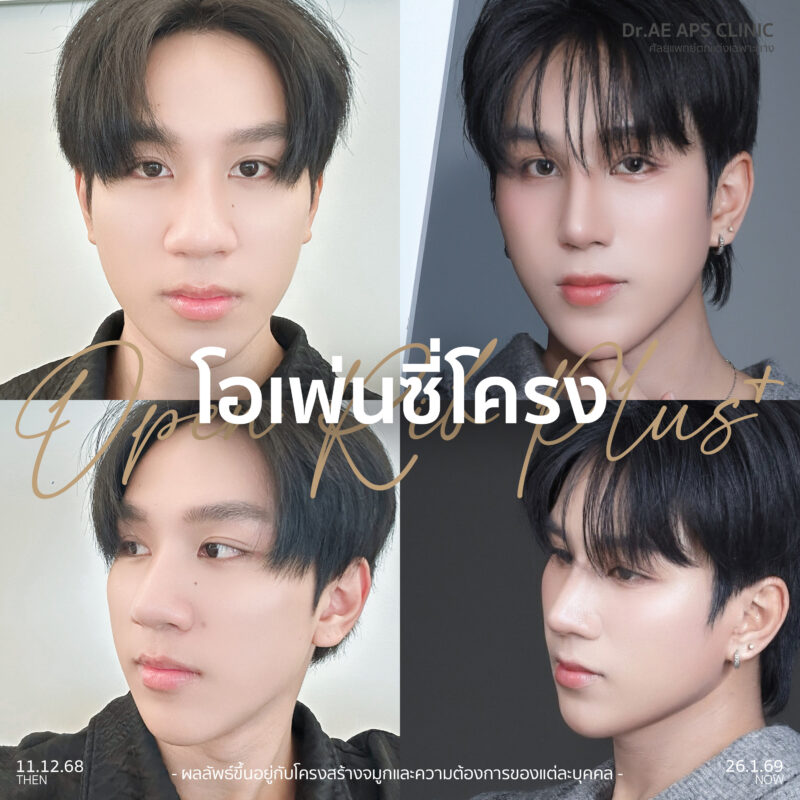 จมูกใหญ่