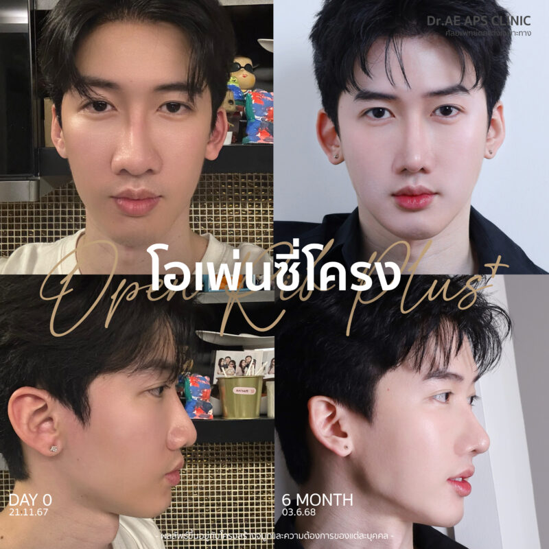 จมูกใหญ่