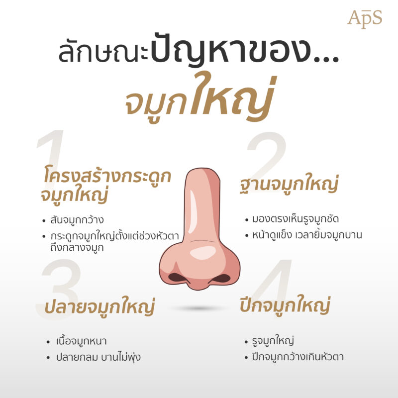 ลักษณะปัญหาของจมูกใหญ่