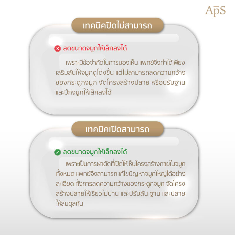 เสริมจมูกเทคนิคไหนแก้ปัญหาจมูกใหญ่ได้ดีกว่า