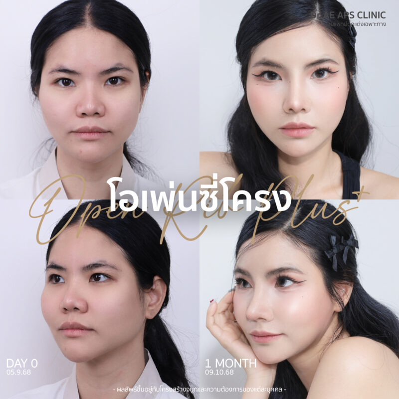 จมูกใหญ่