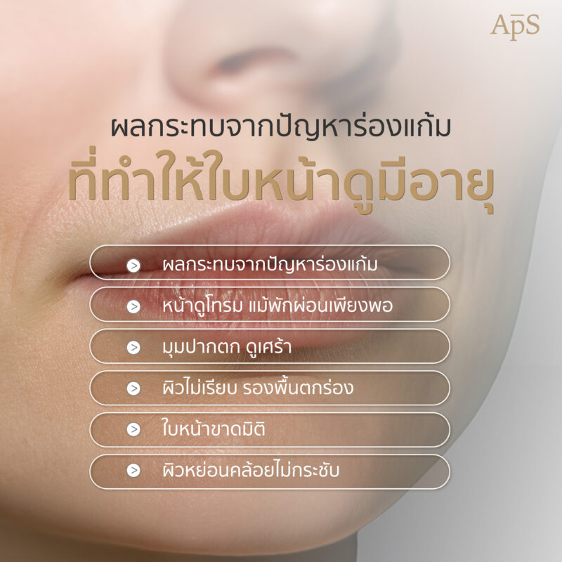 ผลกระทบจากการมีร่องแก้ม