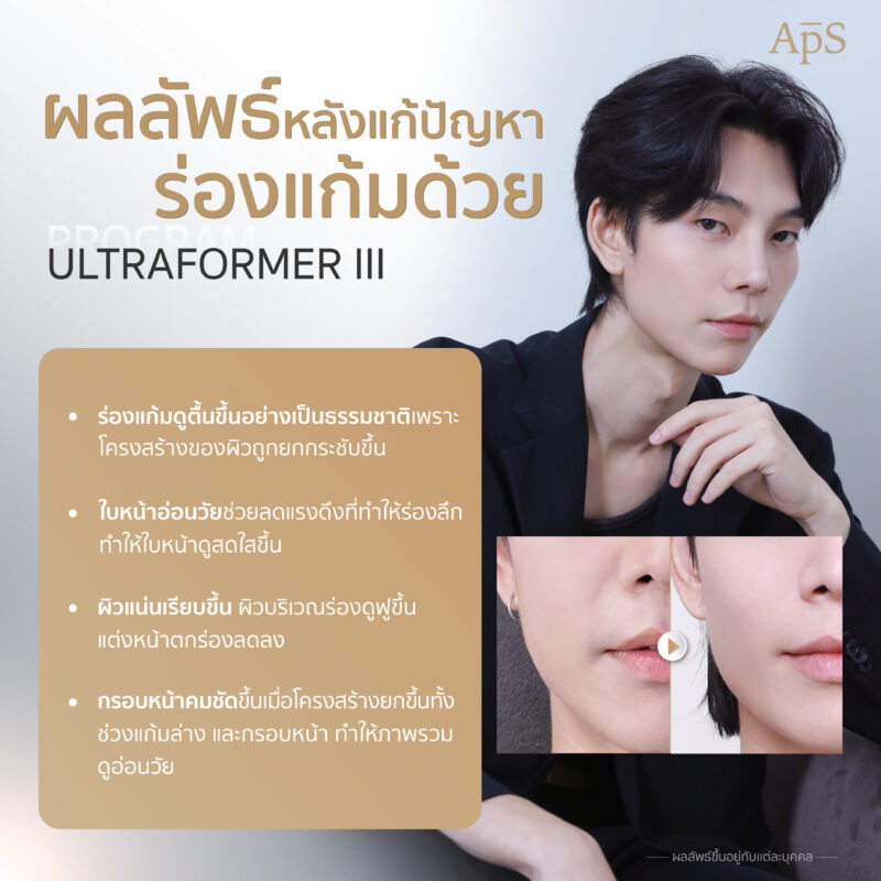 ผลลัพธ์หลังจากการทำโปรแกรม Ultraformer III 