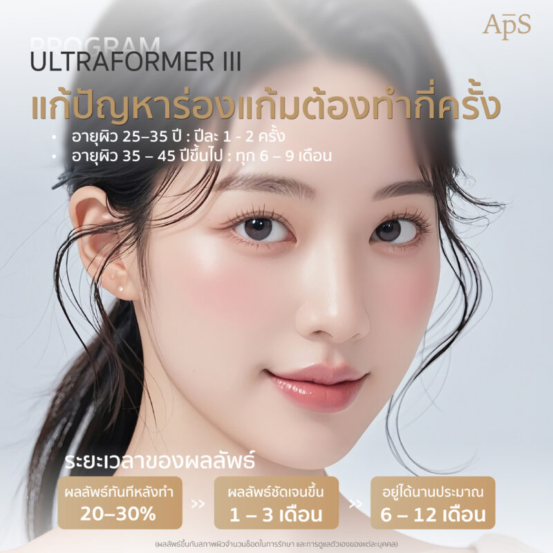 โปรแกรม Ultraformer III แก้ปัญหาร่องแก้มต้องทำกี่ครั้ง