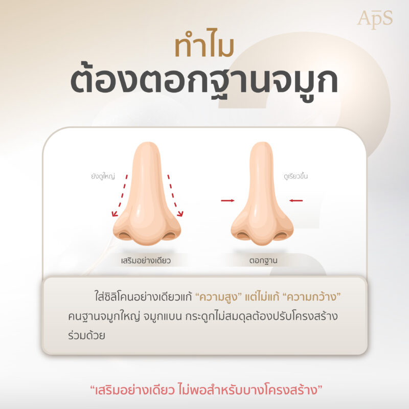 ตอกฐานจมูก ปรับโครงสร้างจมูกให้โด่งได้รูปรับกับใบหน้า 2 ทำไมถึงควรตอกฐานจมูก