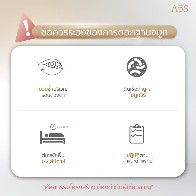 ตอกฐานจมูก ปรับโครงสร้างจมูกให้โด่งได้รูปรับกับใบหน้า 5 ความเสี่ยงและข้อควรระวังของการตอกฐานจมูก