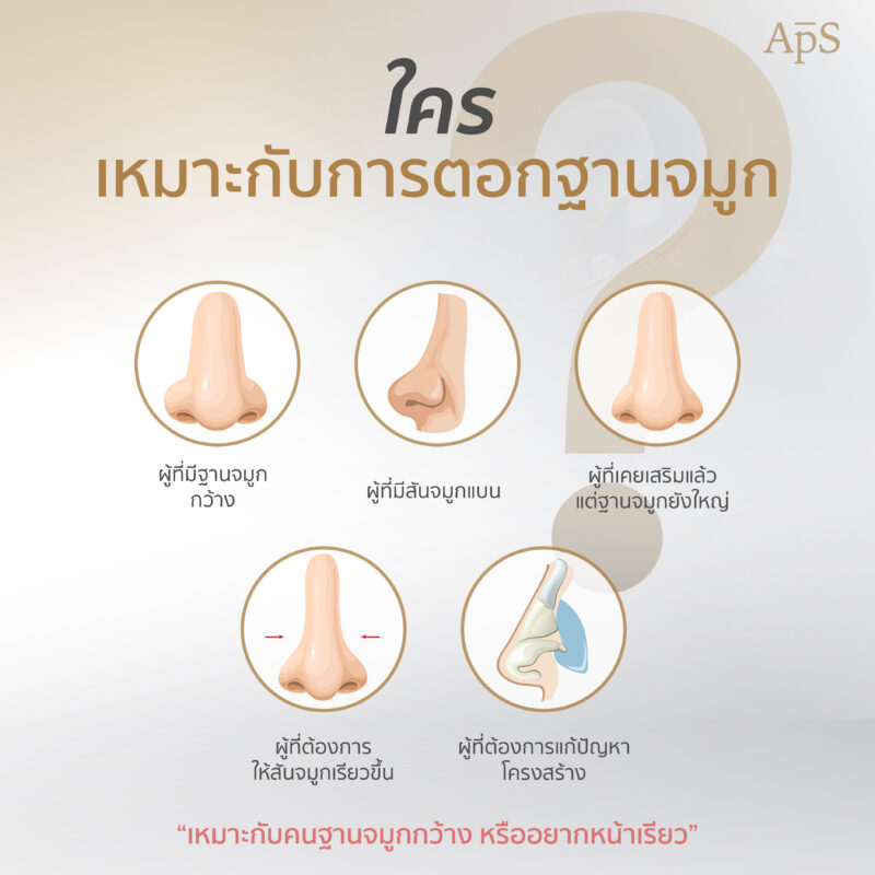 ตอกฐานจมูก ปรับโครงสร้างจมูกให้โด่งได้รูปรับกับใบหน้า 7 การดูแลหลังตอกฐานจมูก