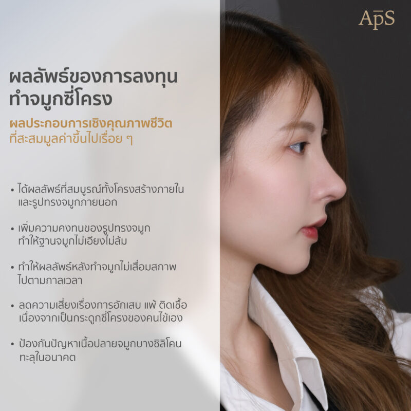 ผลลัพธ์องการเสริมจมูกด้วยกระดูกอ่อนซี่โครง