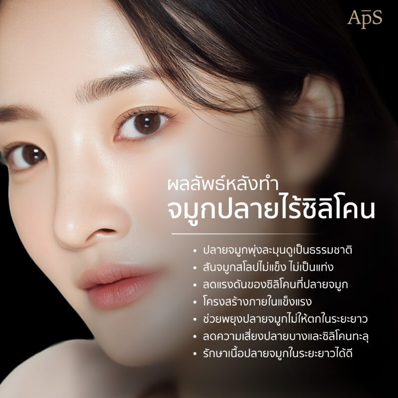 ผลลัพธ์หลังการทำจมูกปลายไร้ซิลิโคน 