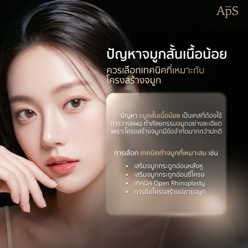 โดยทั่วไปแล้วจมูกของคนเราประกอบด้วยโครงสร้างหลัก ได้แก่