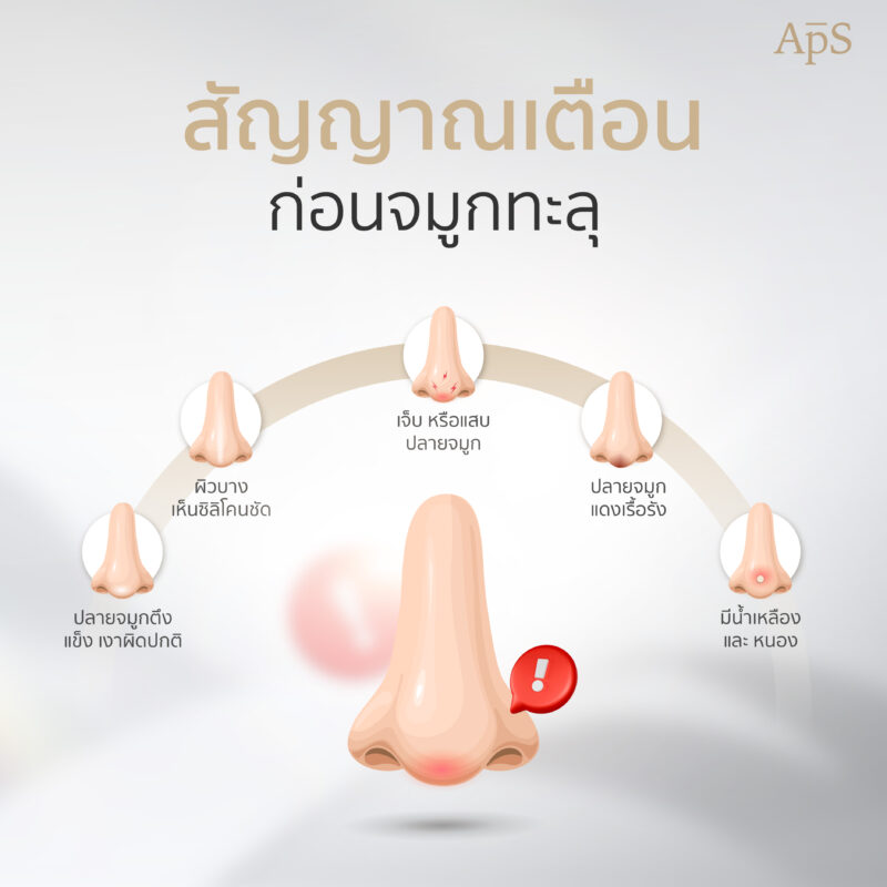สัญญาณเตือนก่อนจมูกทะลุ
