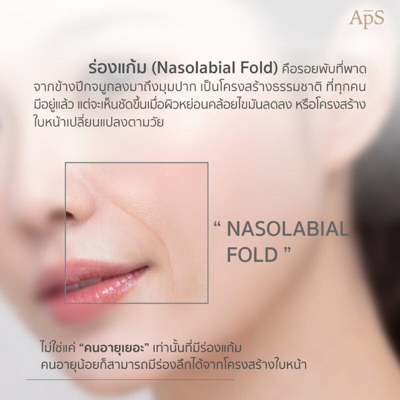 ร่องแก้ม