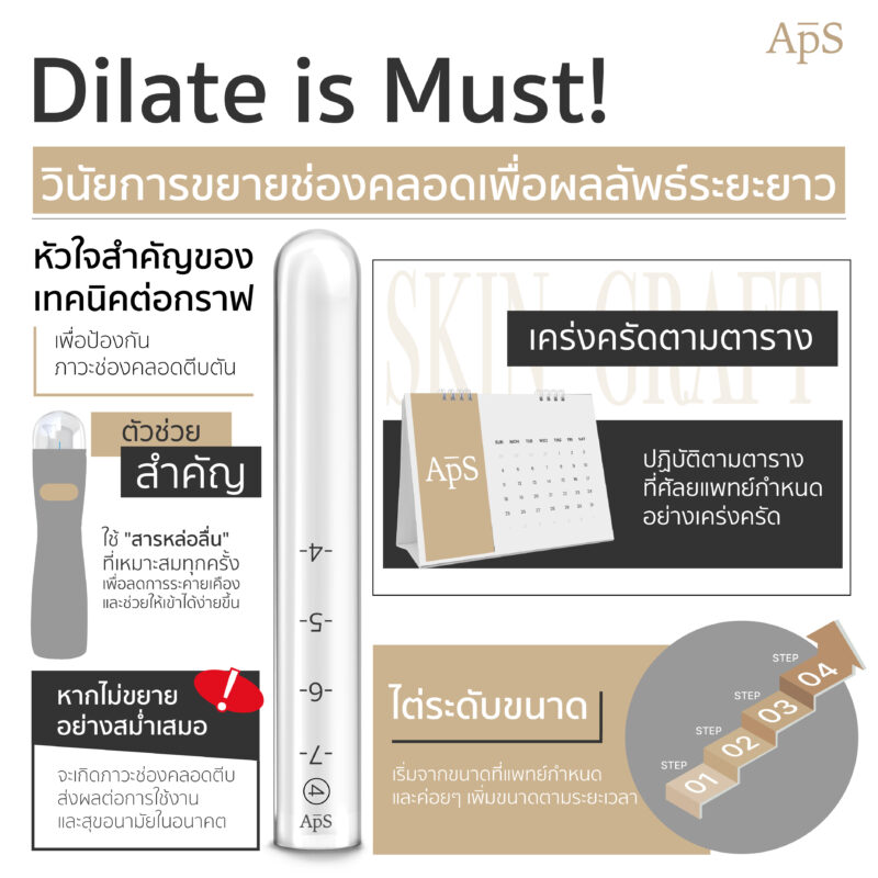 การขยายช่องคลอด