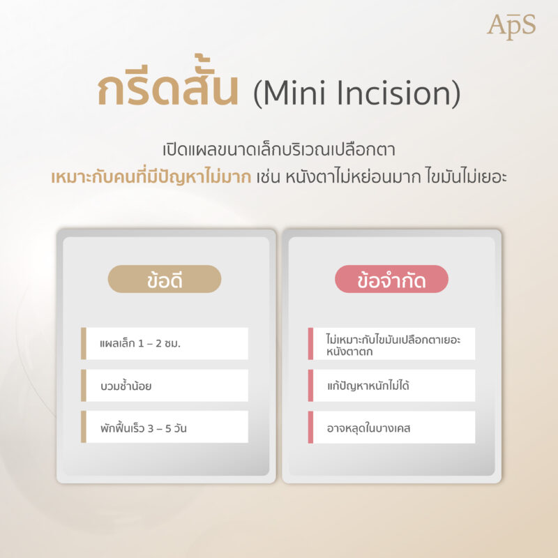 การทำตาสองชั้นเทคนิคกรีดยาว คืออะไร? มีข้อดียังไง 6 ทำตาสองชั้นเทคนิคกรีดสั้น (Mini incision)