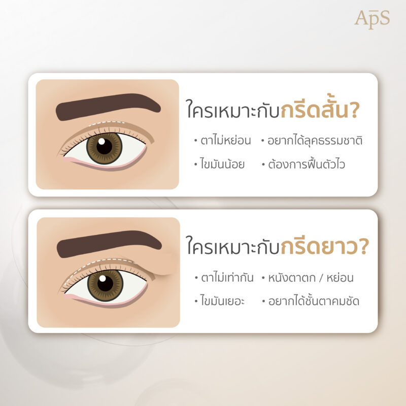 การทำตาสองชั้นเทคนิคกรีดยาว คืออะไร? มีข้อดียังไง 4 ใครเหมาะกับเทคนิคทำตาสองชั้นแบบใด