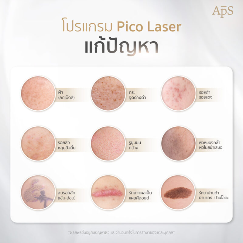 โปรแกรม Pico Laser ใช้แก้ปัญหาอะไรได้บ้าง