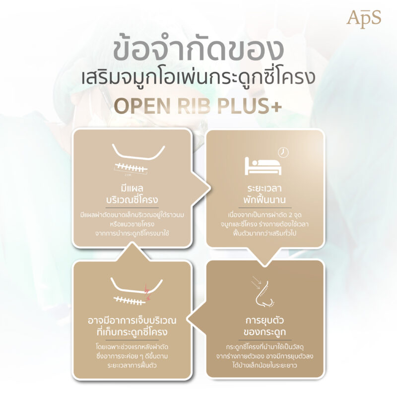 ข้อจำกัดของการเสริมจมูกโอเพ่นกระดูกซี่โครงเทคนิค Open Rib Plus+ 