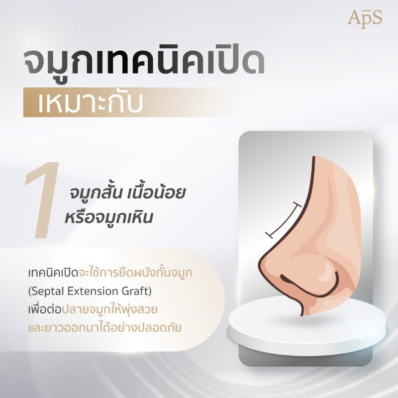 ทำจมูกเทคนิคเปิดเหมาะกับ จมูกสั้น เนื้อน้อย จมูกเหิน
