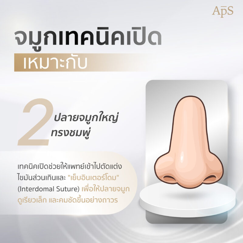 ทำจมูกเทคนิคเปิดเหมาะกับ ปลายจมูกใหญ่ทรงชมพู่