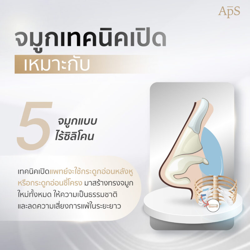 ทำจมูกเทคนิคเปิดเหมาะกับ จมูกแบบไร้ซิลิโคน