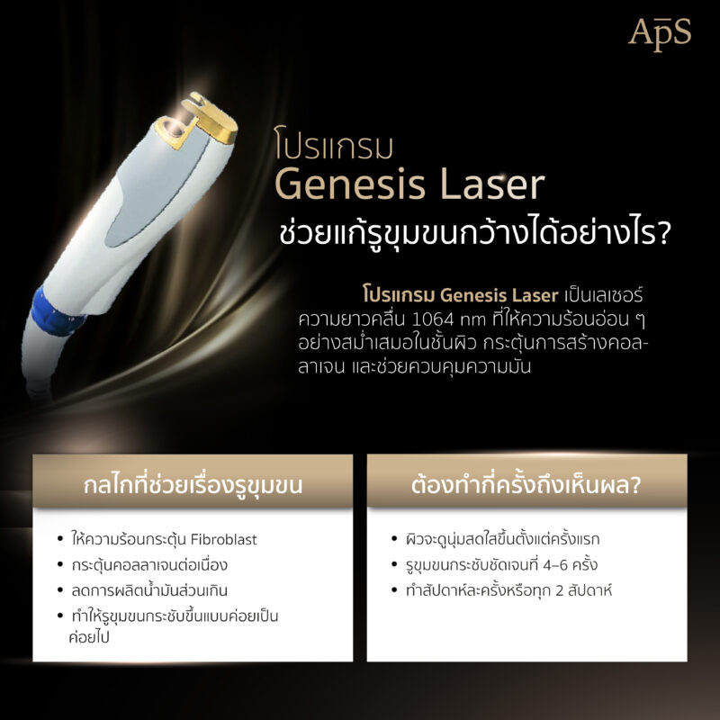 Gensis Laser