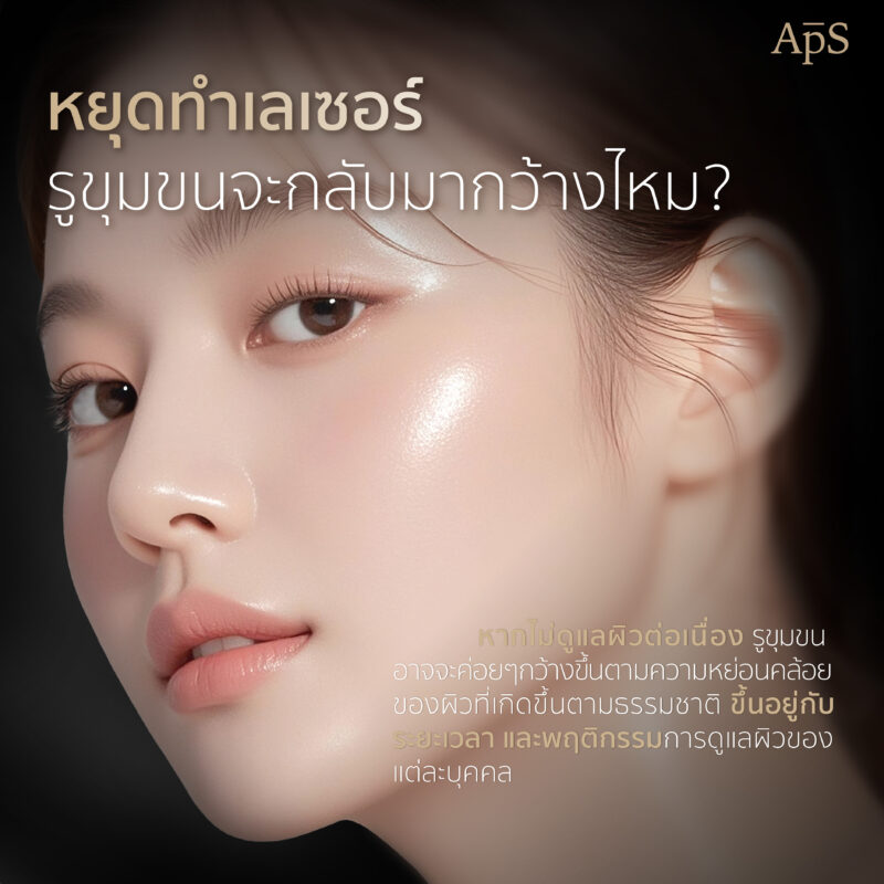 หยุดทำเลเซอร์รูขุมขนจะกลับมากว้างไหม