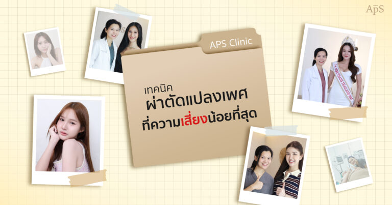 ข้อจำกัดของการแปลงเพศต่อกราฟ