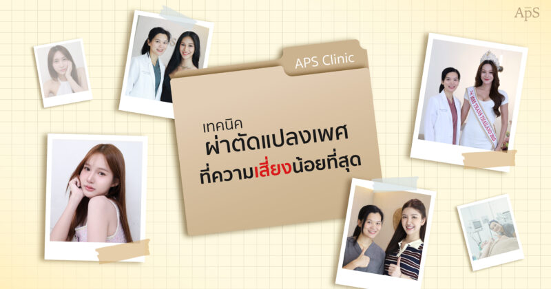 ข้อจำกัดของการแปลงเพศต่อกราฟ
