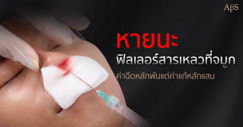 แก้จมูกเลาะสารเหลว