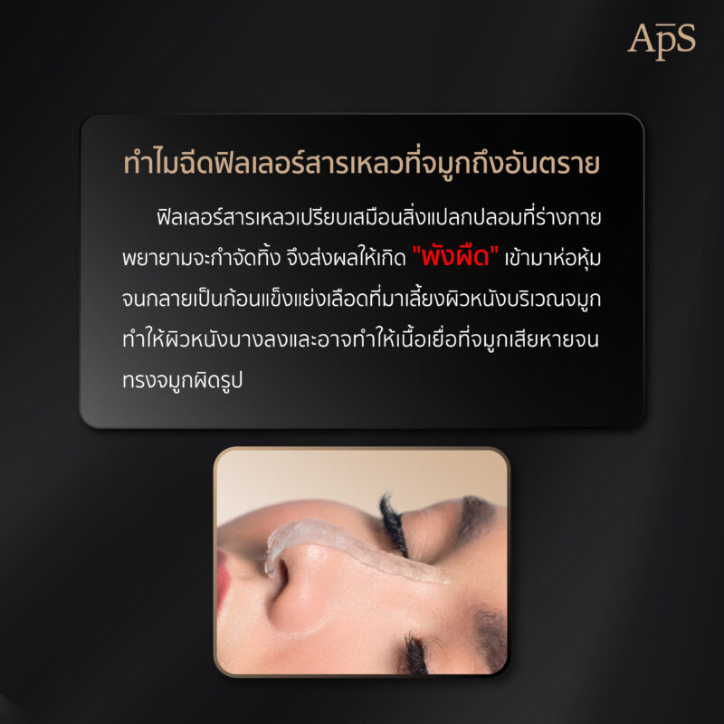 สารเหลวในจมูก