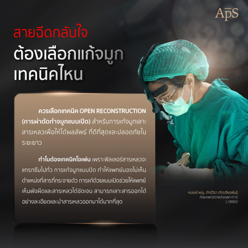 ทำไมแก้จมูกเลาะสารเหลว ถึงราคาสูง